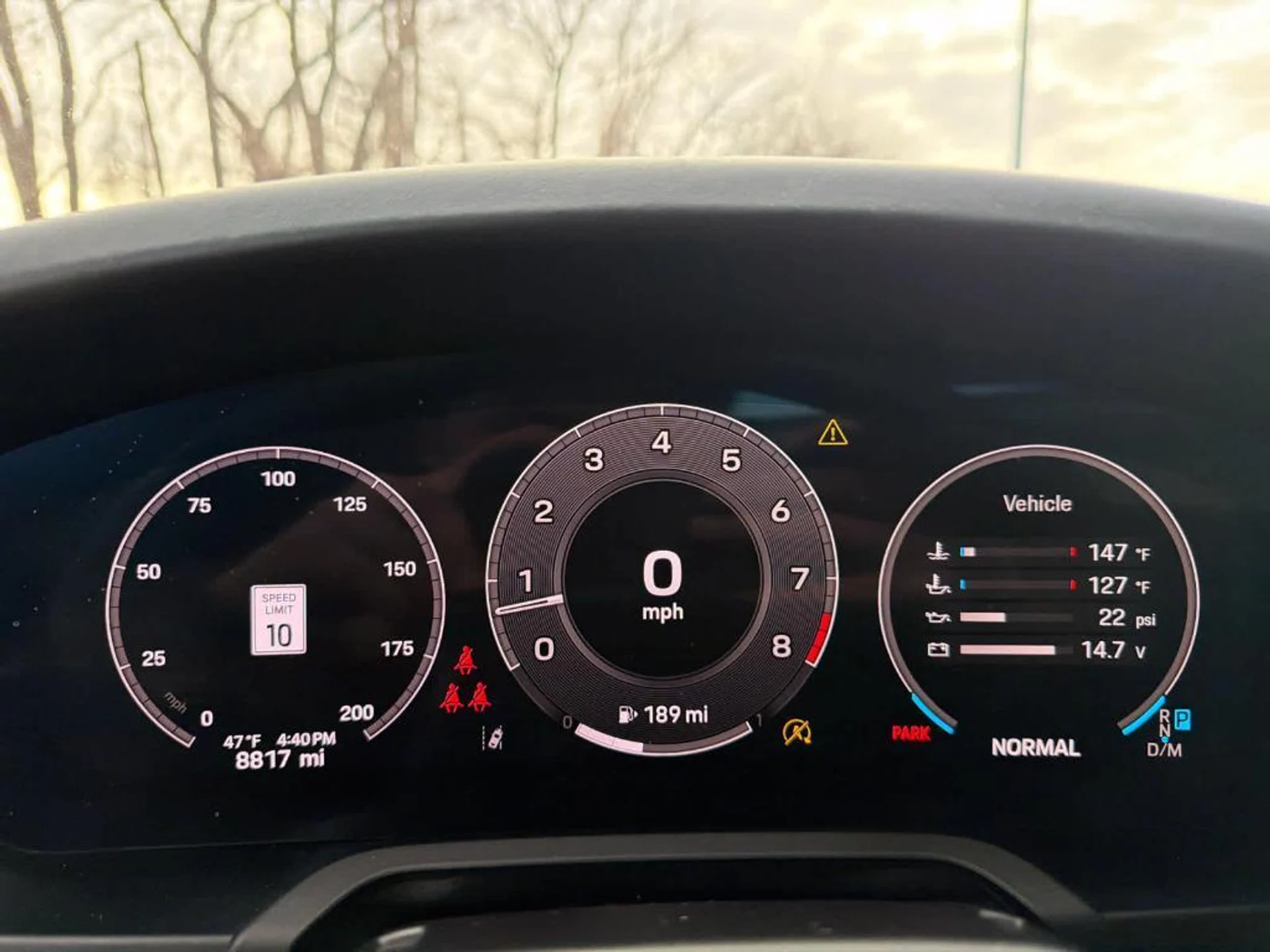 mph022_2040378633_ih4x0_NUI_By_Myh_4_Q_Sdv_S_Wwf_ACO_4_1c794094ca